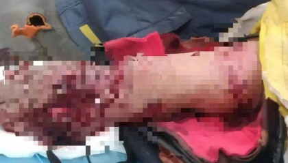 老虎扑咬 73 岁老人撞到铁栅栏，家属：老虎咬人后欲闯我家